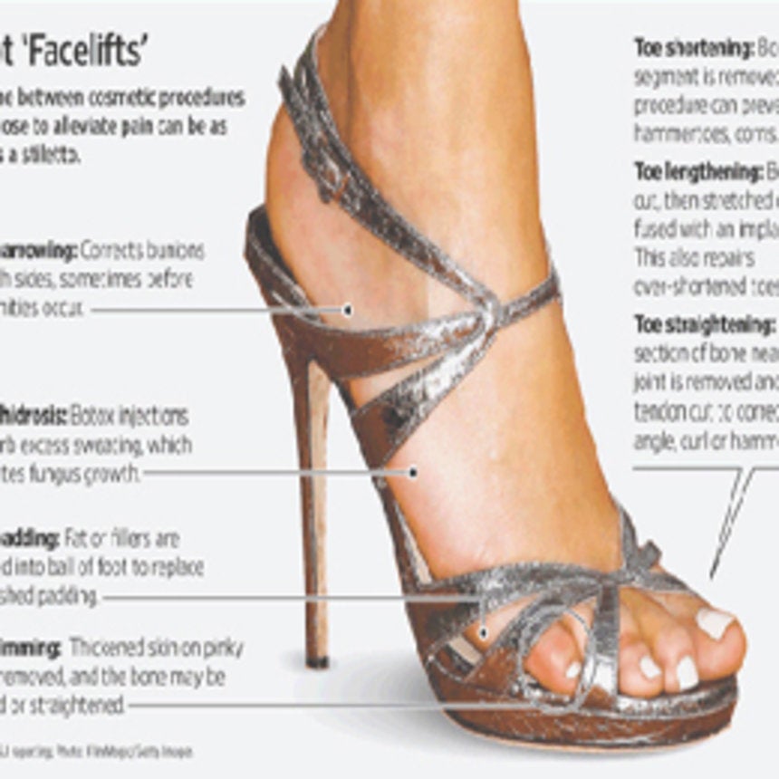 Cosmetic Surgery to Fit into High Heels?