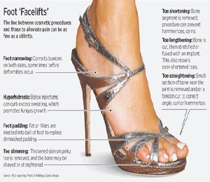Cosmetic Surgery to Fit into High Heels?