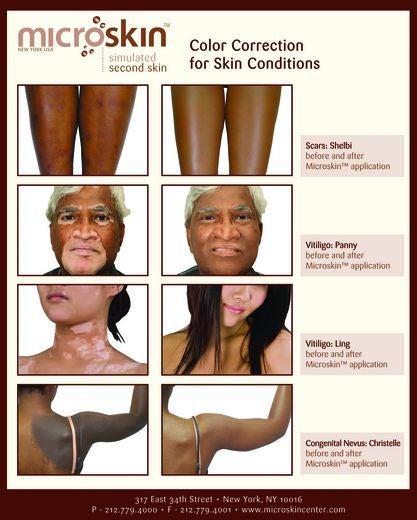 ESSENCE 2011 Beauty Awards: Base