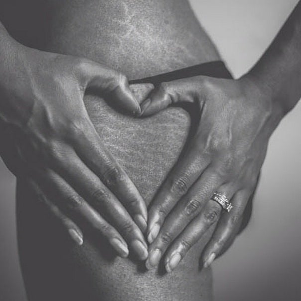Instagram’s ‘Love Your Lines’ Campaign Celebrates Stretch Marks