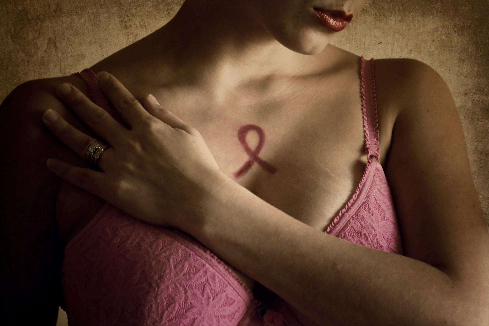 Breast Cancer Rate Among Black Women Equal To White Women's For First Time
