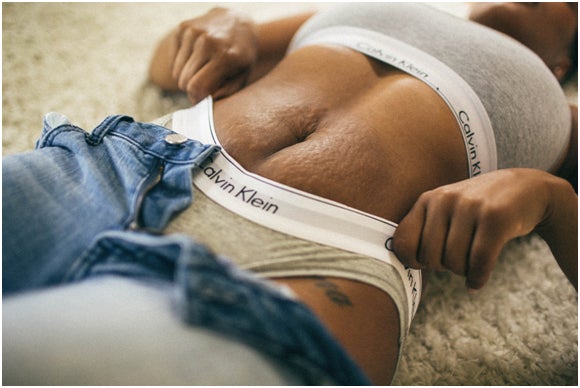 Love Your Lines: Stop Trying to Fade, Erase or Hide Your Stretch Marks