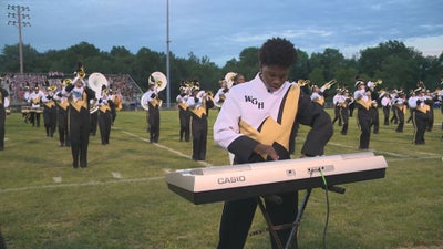 Inspiring Teen Musician With Prosthetic Legs & Four Fingers Shines In High School Band