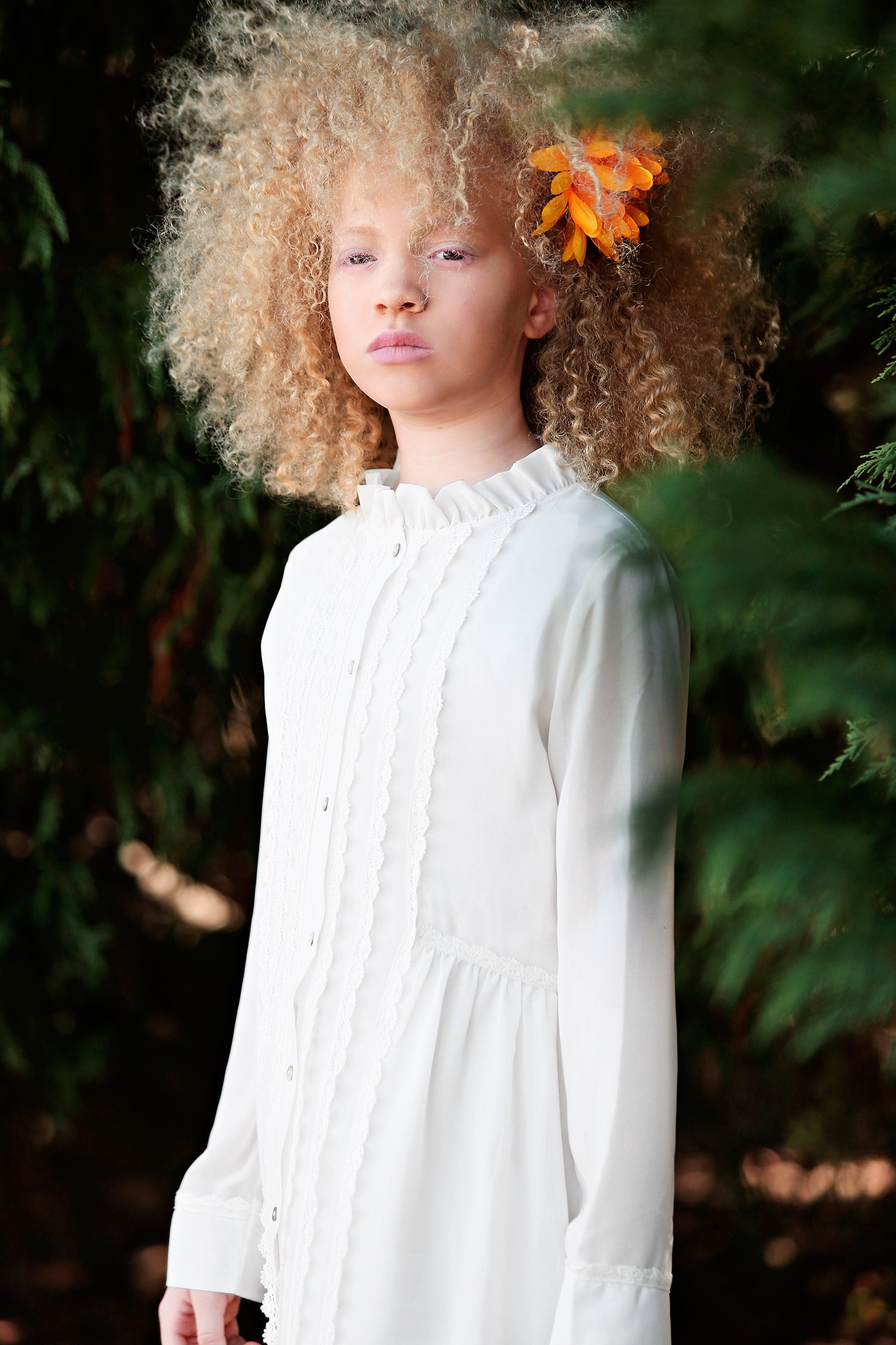 Ava Clarke & Shala Edney Tell Us Why Albinism Is The 'Perfect Flaw'
