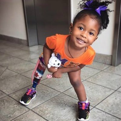 This Adorable 2-Year-Old Princess Isn’t Letting A Prosthetic Leg Steal Her Smile