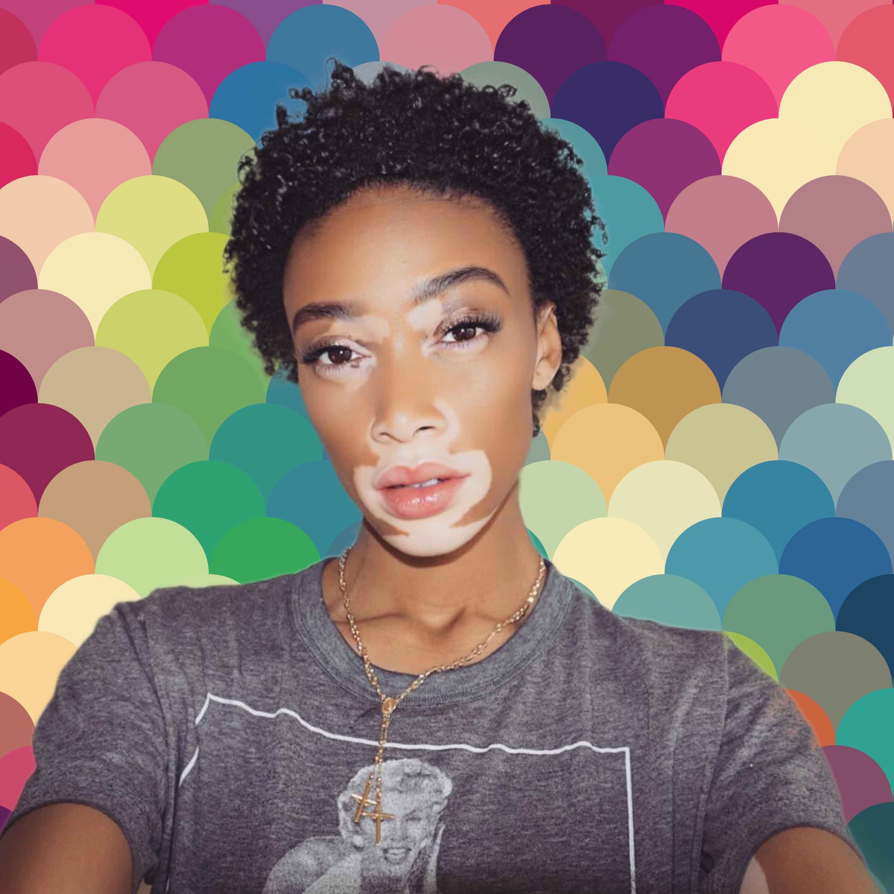 Winnie Harlow Shares a Instagram Video That's Both Surprising and Inspiring
