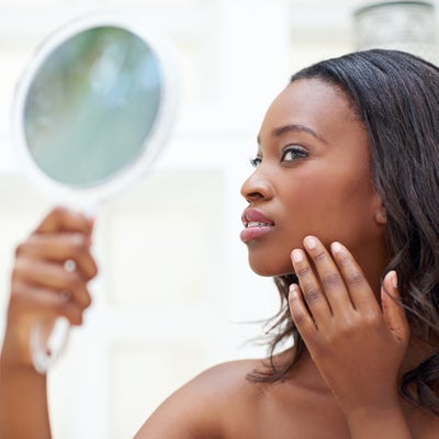 Face It, Sis! The Truth And Lies About Your Acne
