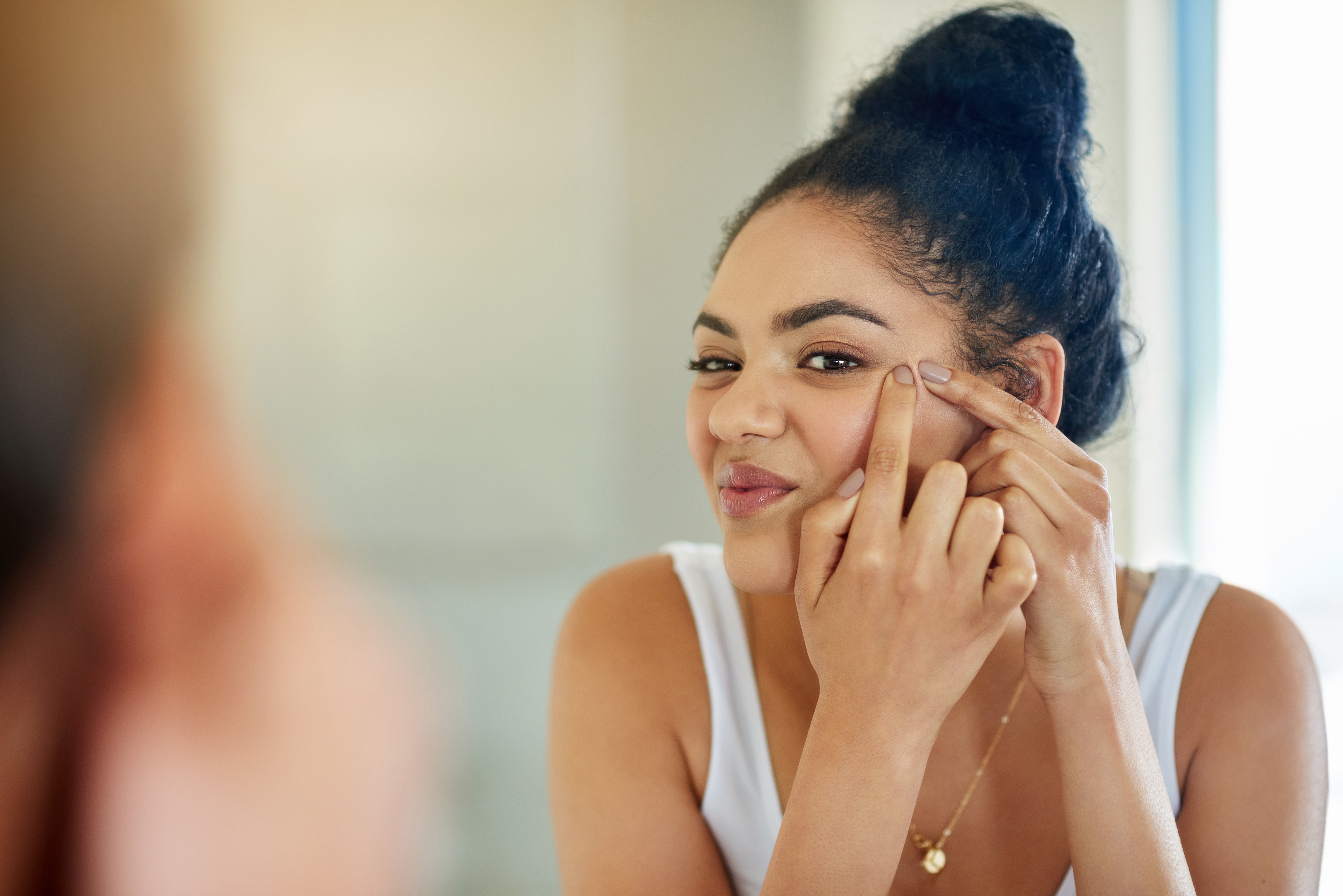 How to get rid of dark spots on black skin