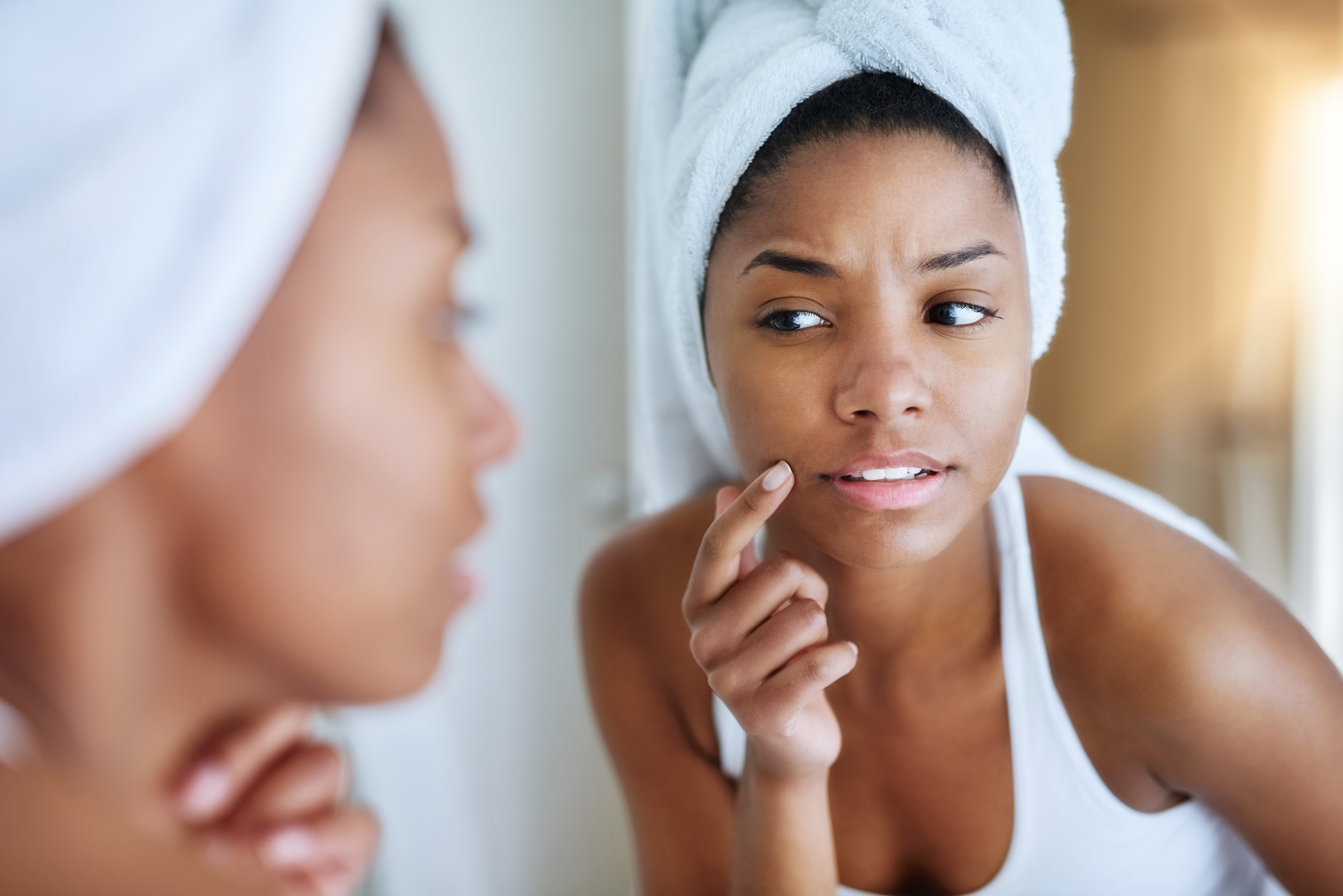 Here's The Best Way To Treat Acne Problems For Darker Complexions
