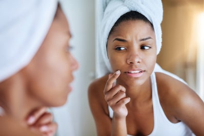 Here’s The Best Way To Treat Acne Problems For Darker Complexions