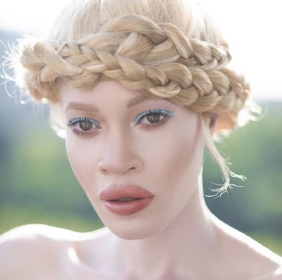 Wet n Wild Chose A Model With Albinism As The Face Of Its New Beauty Campaign