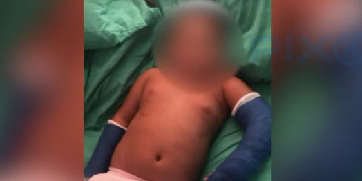 New York City Mom Wants Answers After Son Comes Home From School With Broken Arms
