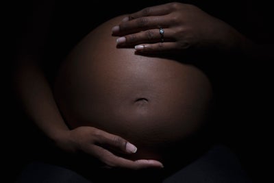 Racism Is The Root, Sustaining Cause Of Black Infant Mortality