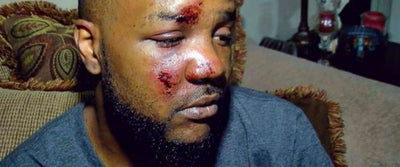 Mississippi Cops Dismissed After Allegedly Beating A Black Man
