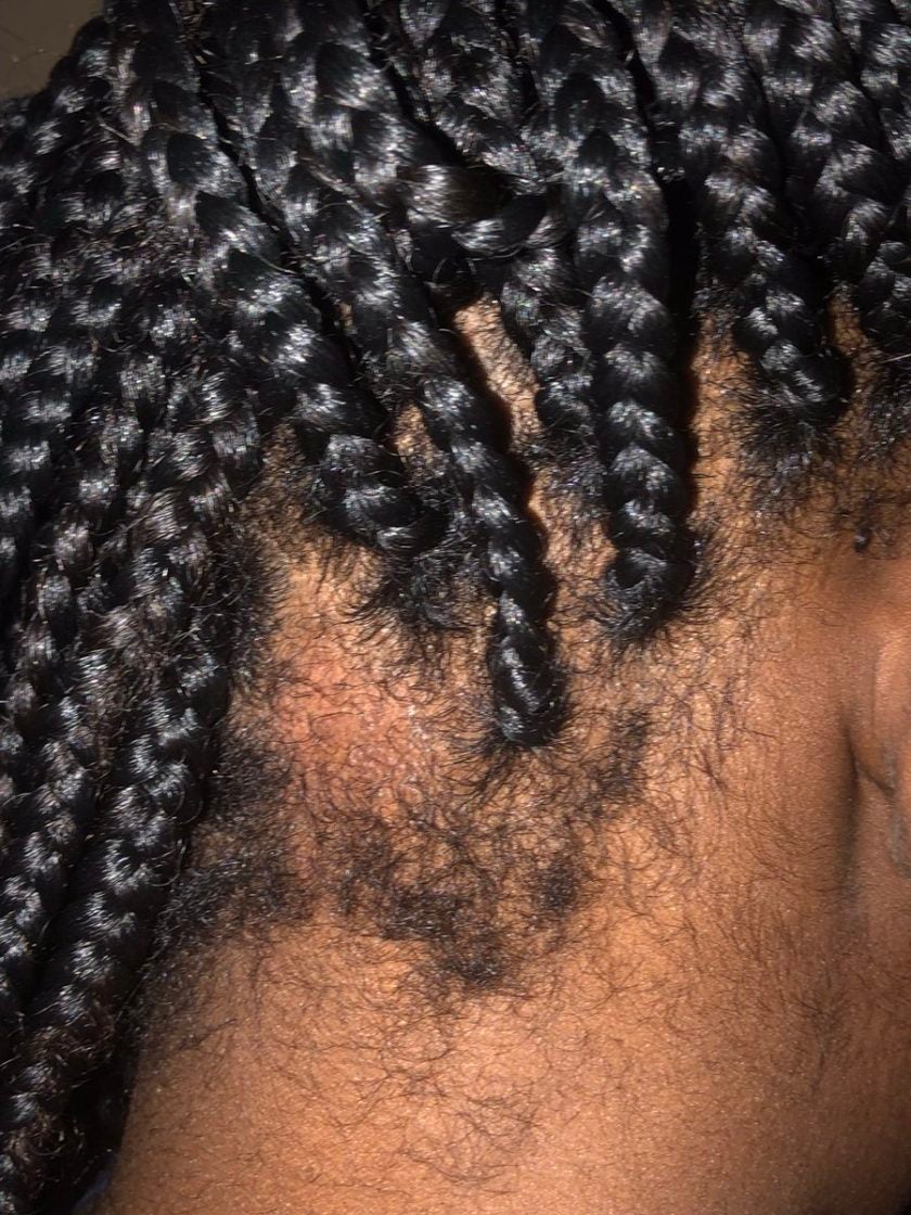 educator fired after ripping braids from student's scalp