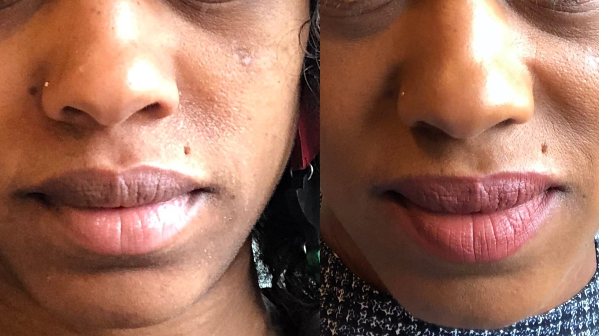 This $8 Drugstore Brand Brought My Skin Back To Life