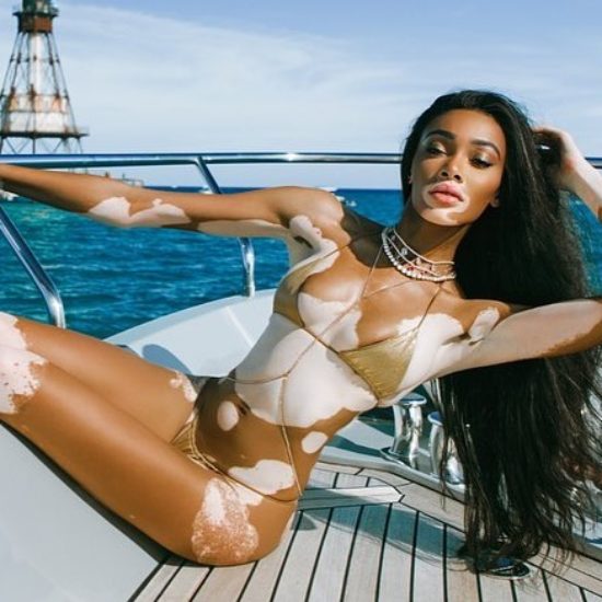 We Want Everything Winnie Harlow Wore For Her 25th Birthday Weekend 