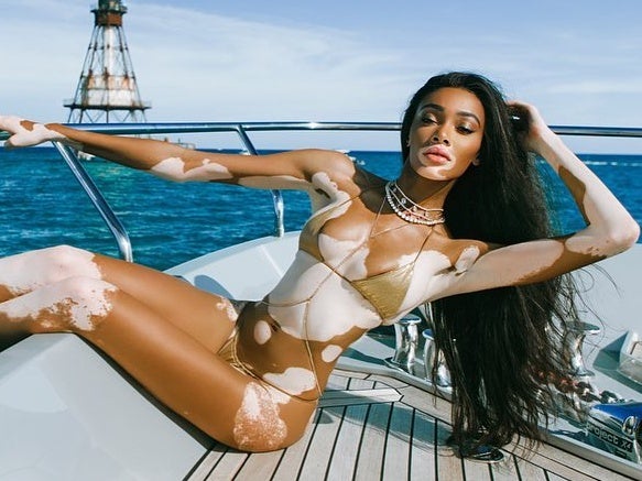 We Want Everything Winnie Harlow Wore For Her 25th Birthday Weekend 