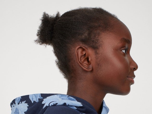 H&M Responds To Backlash Against Its Ad Of A Black Girl With 'Undone' Hair