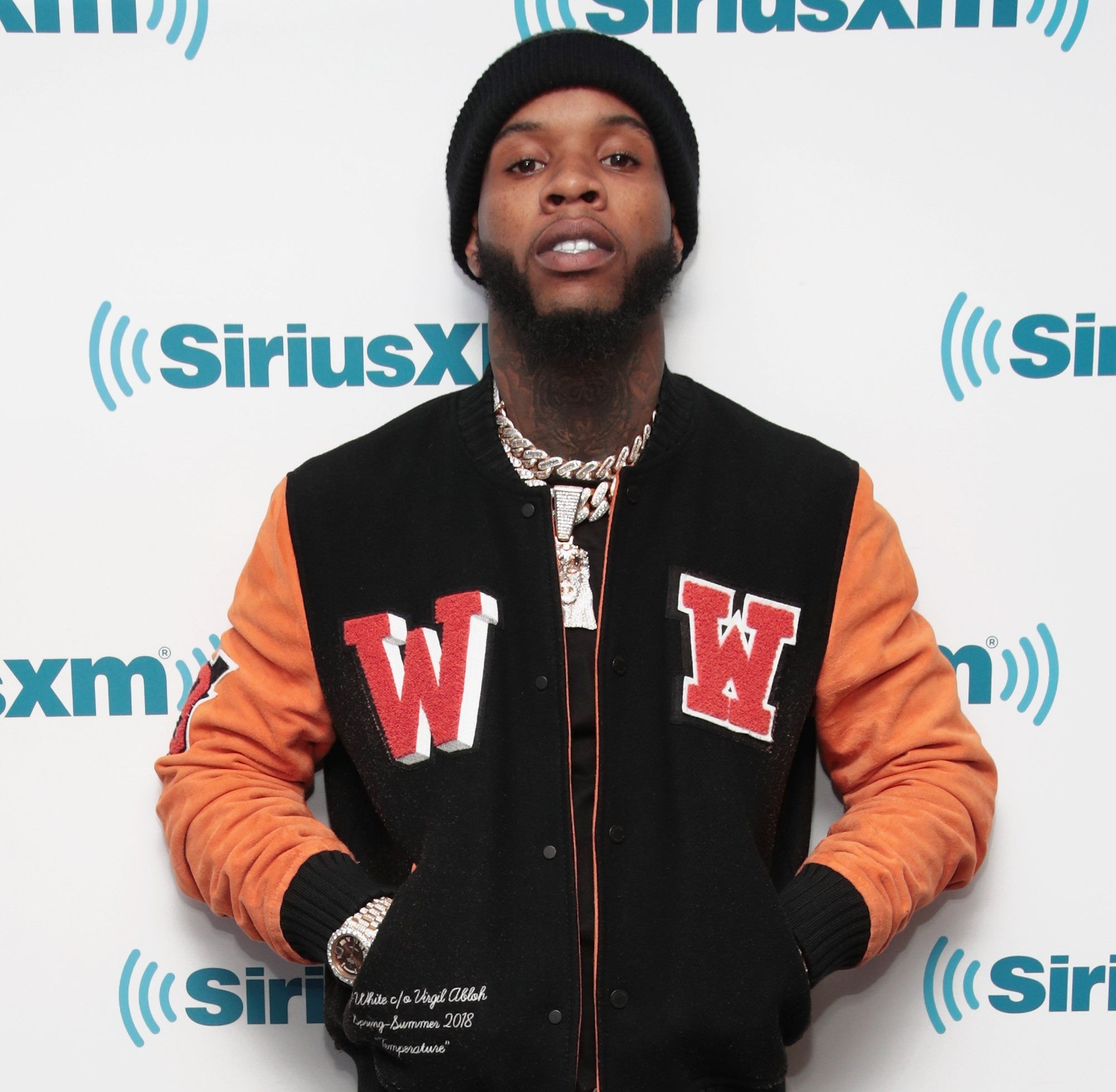 How Tory Lanez Plans To Repay Tyga For New Hairline