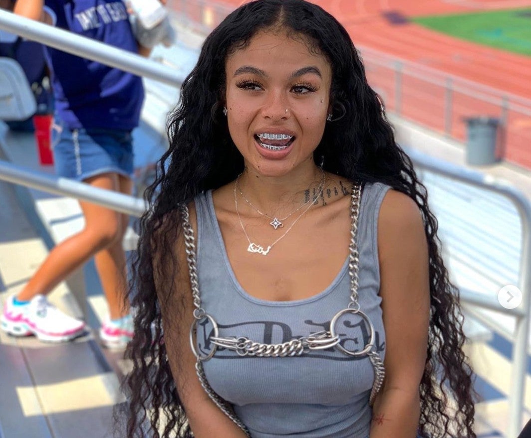 These 15 Beauties In Grillz Make Us Want To Get Some Tooth Bling
