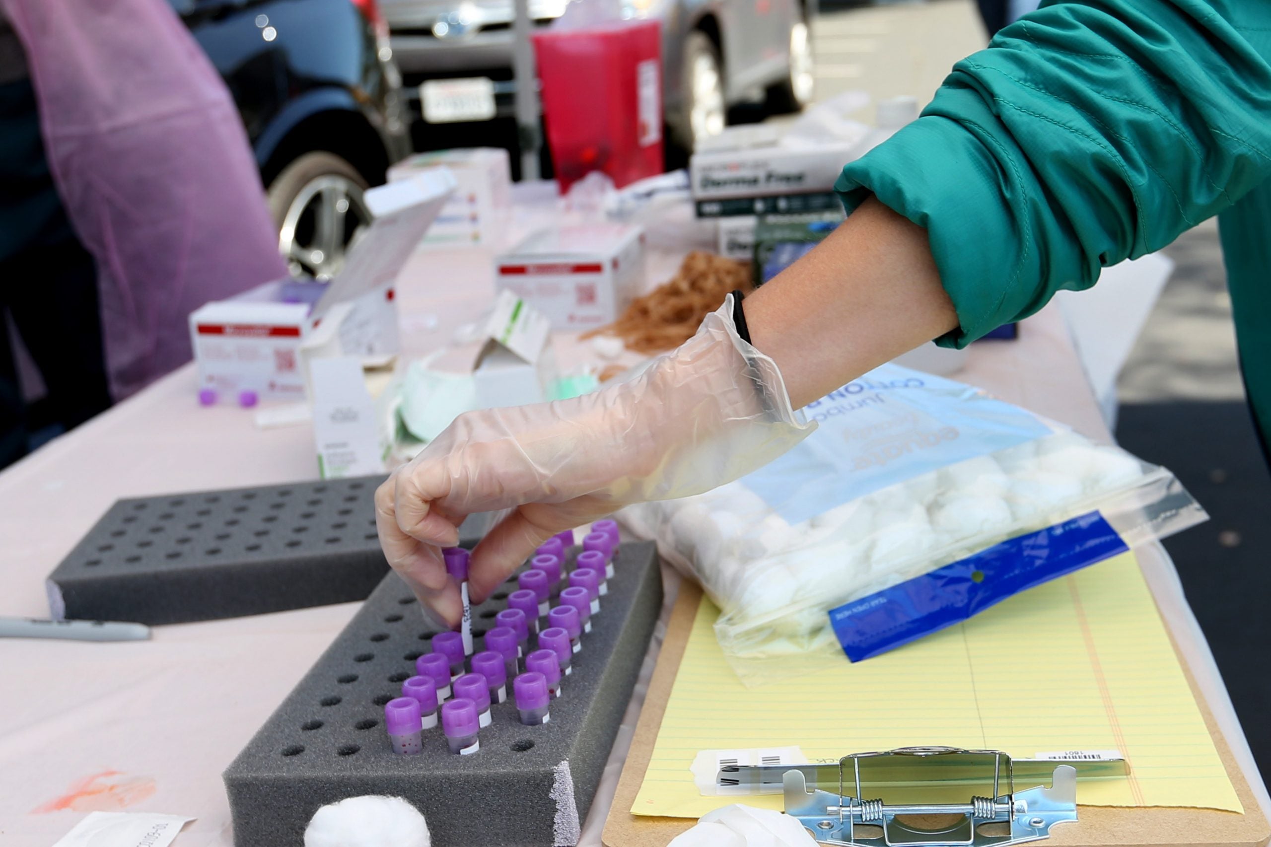 California Had 2 Coronavirus Deaths Before 1st Reported US Death