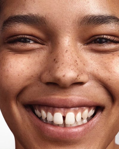 10 Black Models With Unconventional Smiles