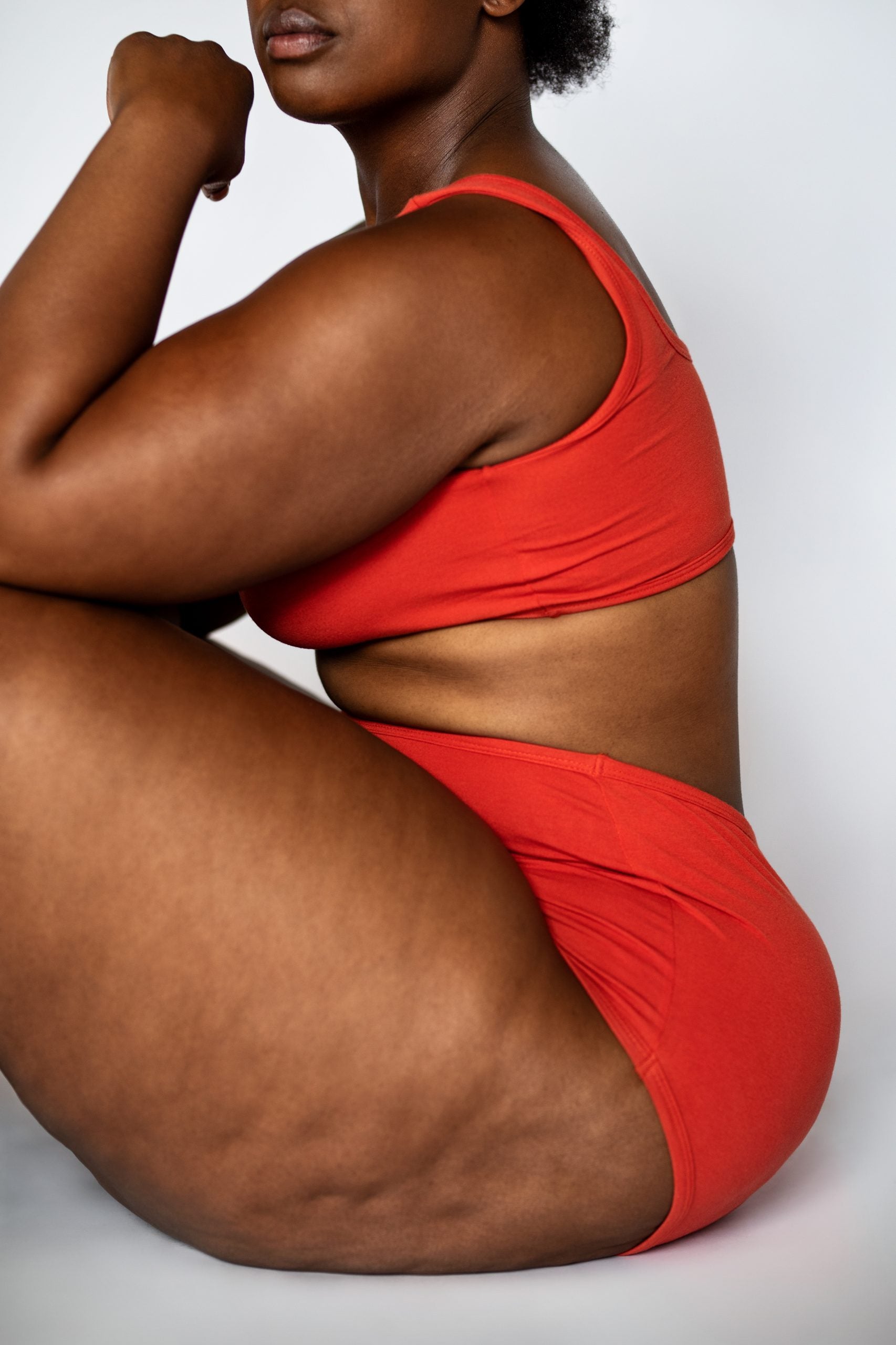 Dermatologist Michelle F. Henry Busts Myths About Cellulite
