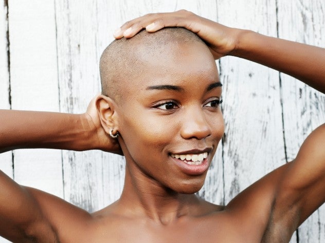 5 Things I Learned About Alopecia During My Hair Growth Journey
