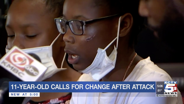 Kansas 11-Year-Old Victim Of Racist Attack, Family Says