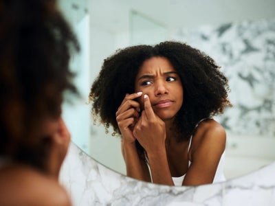This Black Dermatologist Explains How To Treat Hyperpigmentation On Dark Skin