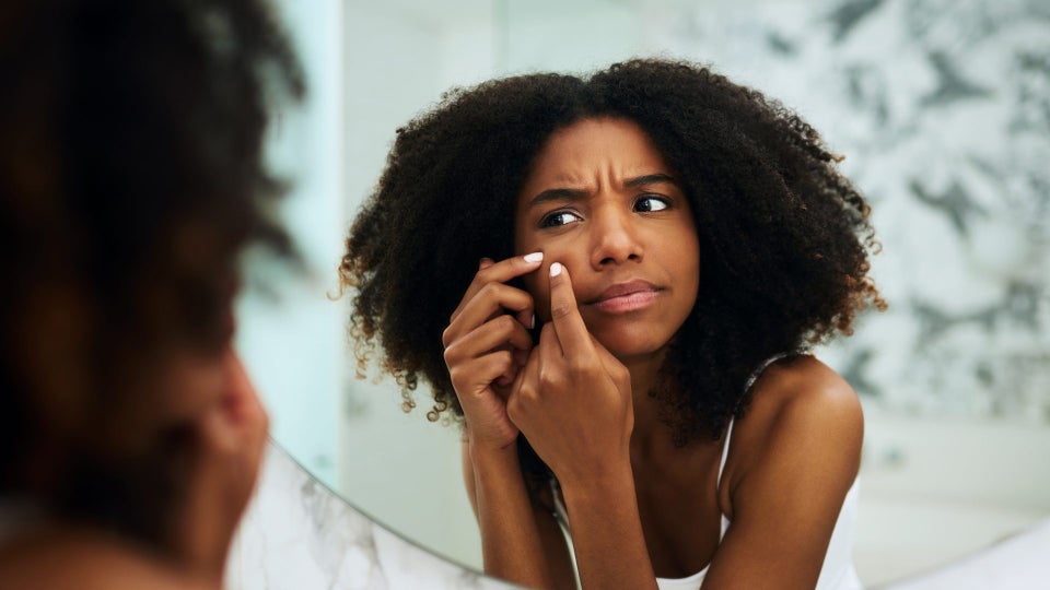 This Black Dermatologist Explains How To Treat Hyperpigmentation On Dark Skin