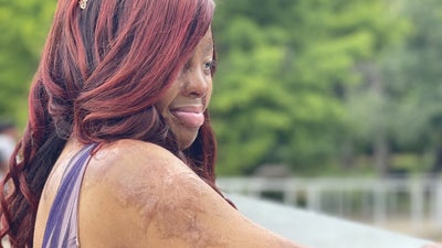 Kechi Okwuchi Talks Survival, Singing, And Self-Love For Face Equality Month