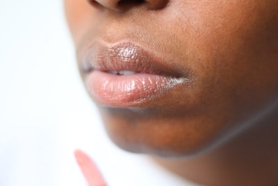 Why Dermal Fillers For Black Women Are Becoming More Prevalent