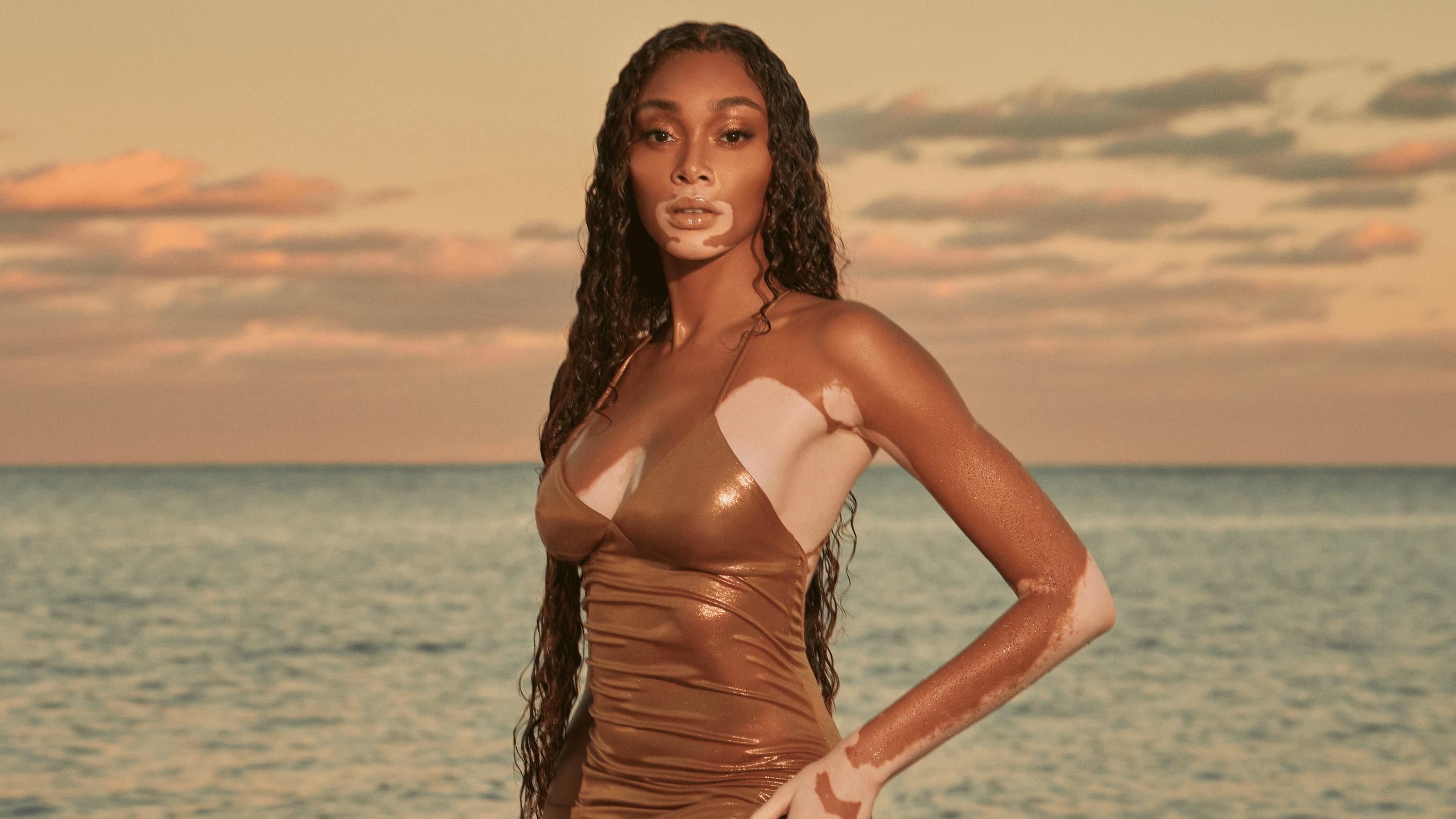 Winnie Harlow's Latest CAY Skin Launch Will Keep You Moisturized