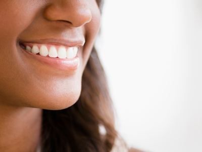 All The Best Teeth Whitening Treatments On Amazon