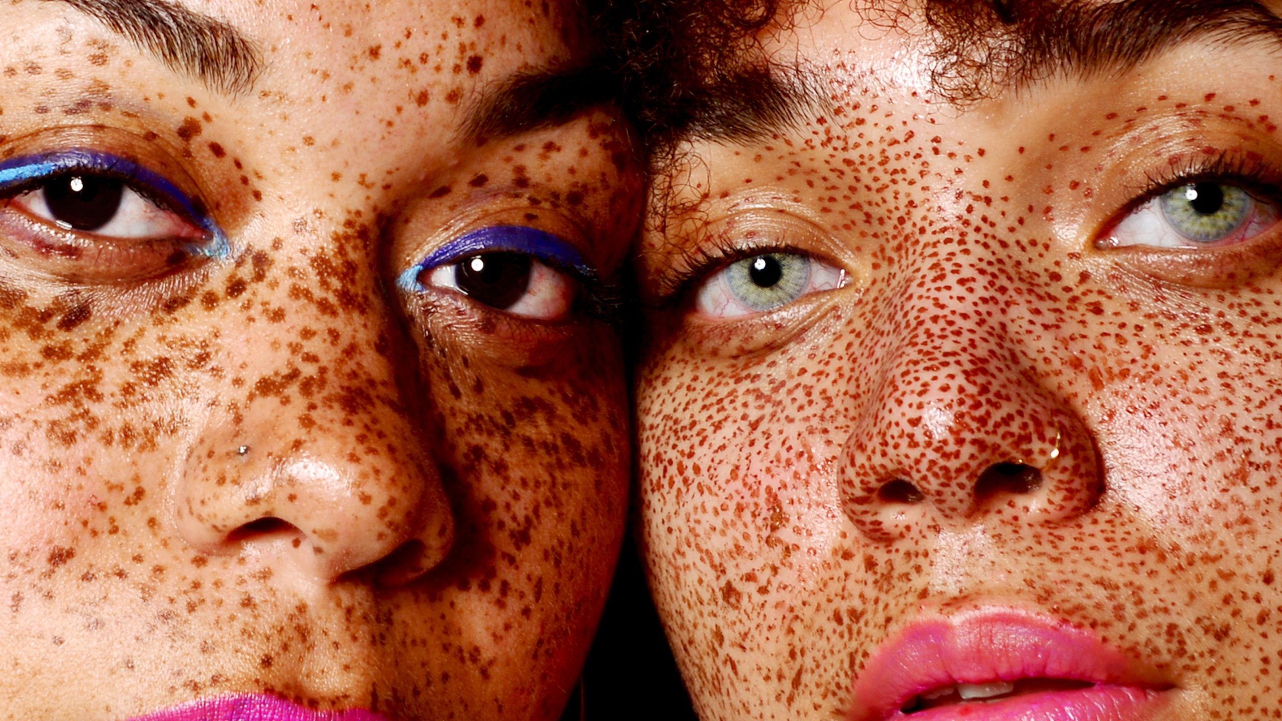 Dermatologist Weighs In On How To Treat Hyperpigmentation On Melanated Skin