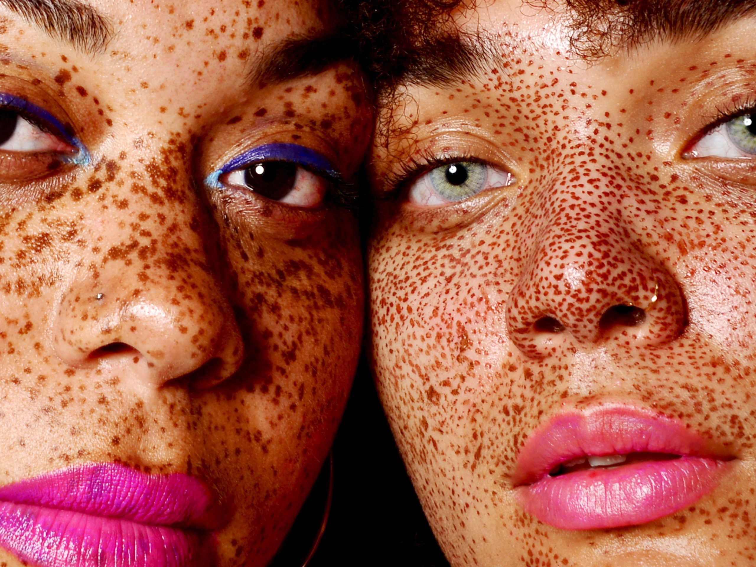 Dermatologist Weighs In On How To Treat Hyperpigmentation On Melanated Skin