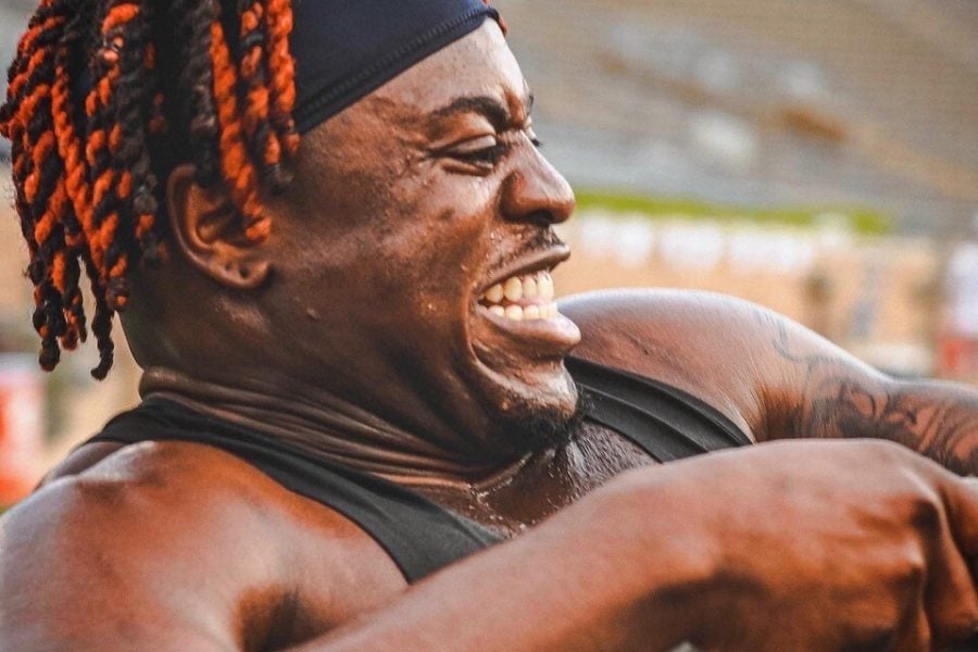 Laser Hair Removal for Men