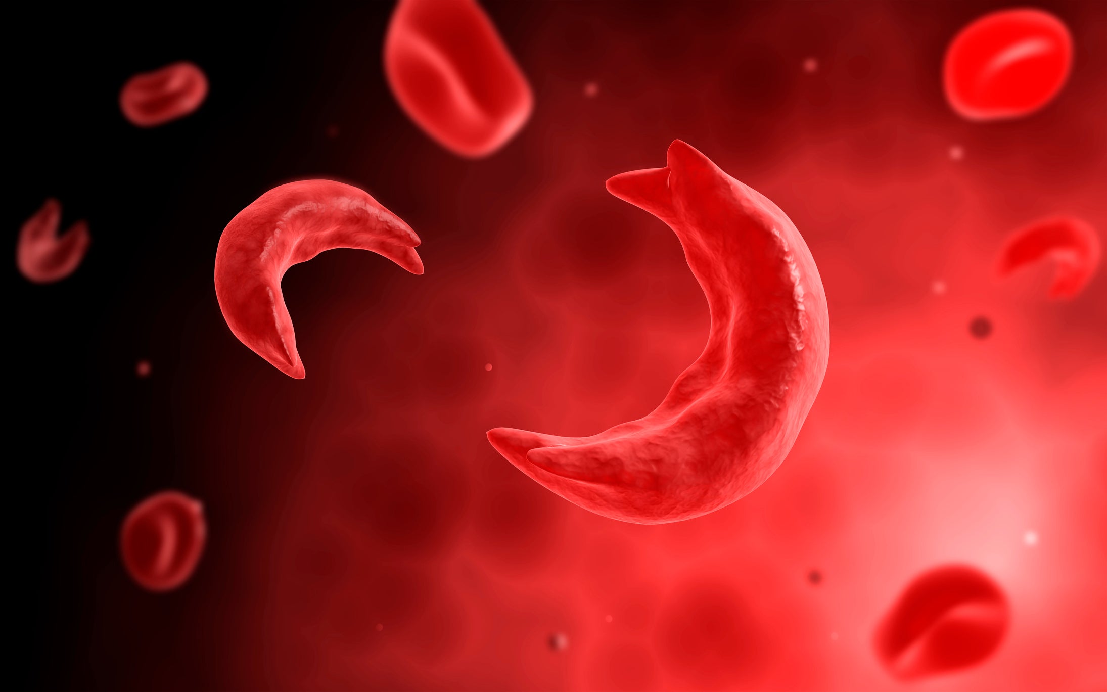 Health Matters: FDA Approves Groundbreaking Gene-Editing Tool That Could Cure Sickle Cell Disease