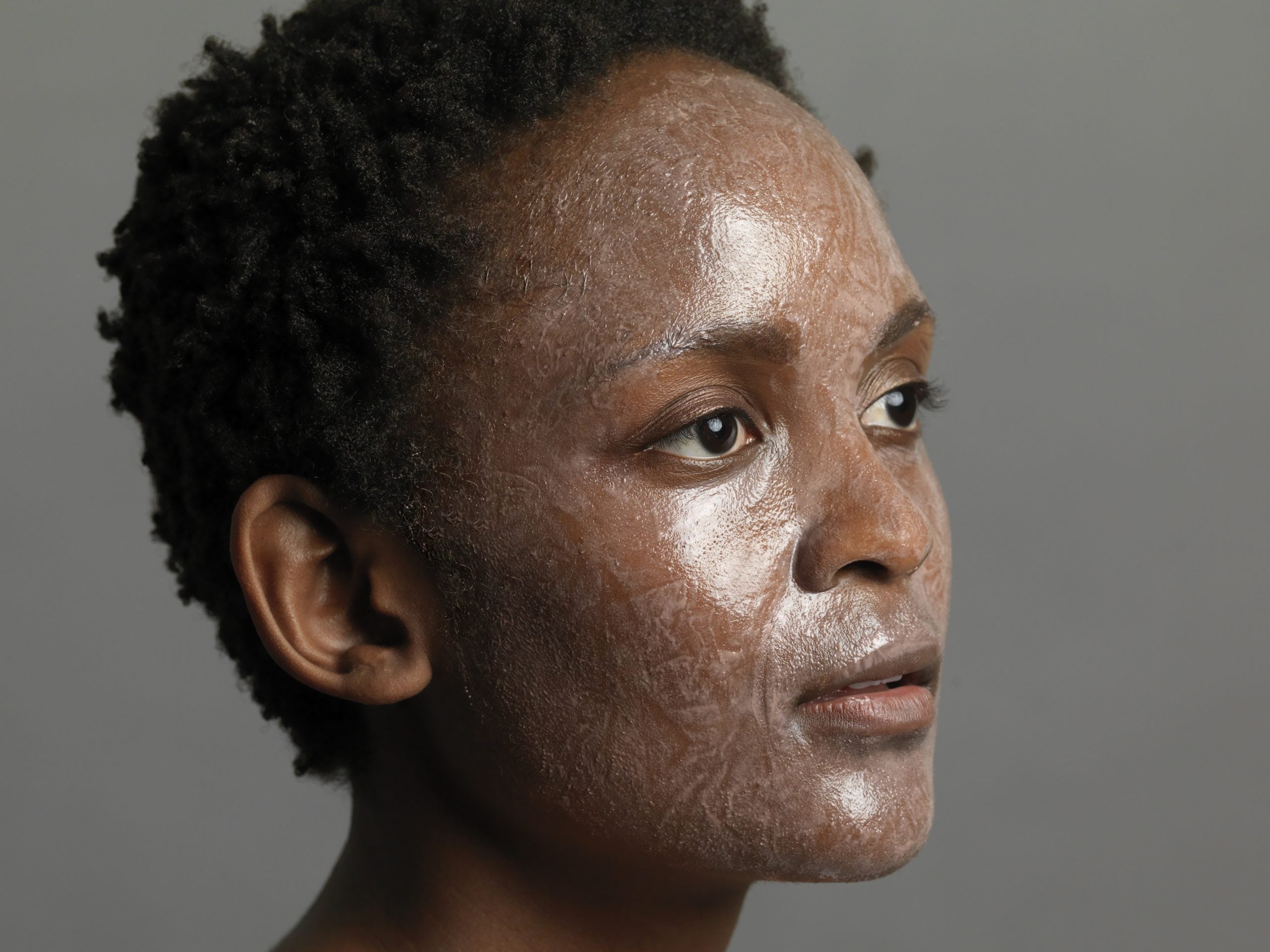 Everything Black Women Need To Know About Chemical Peels