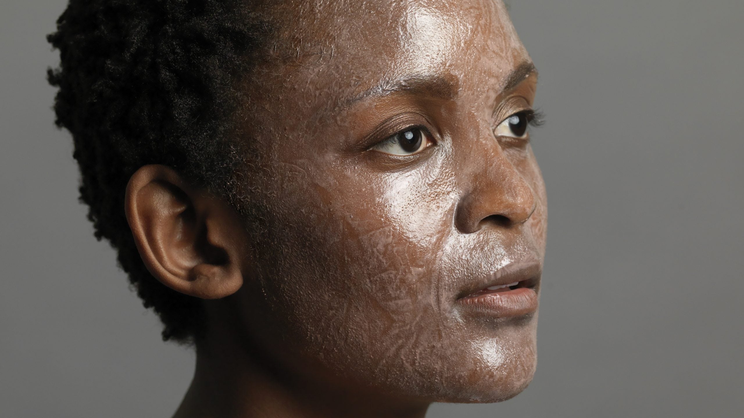 Everything Black Women Need To Know About Chemical Peels