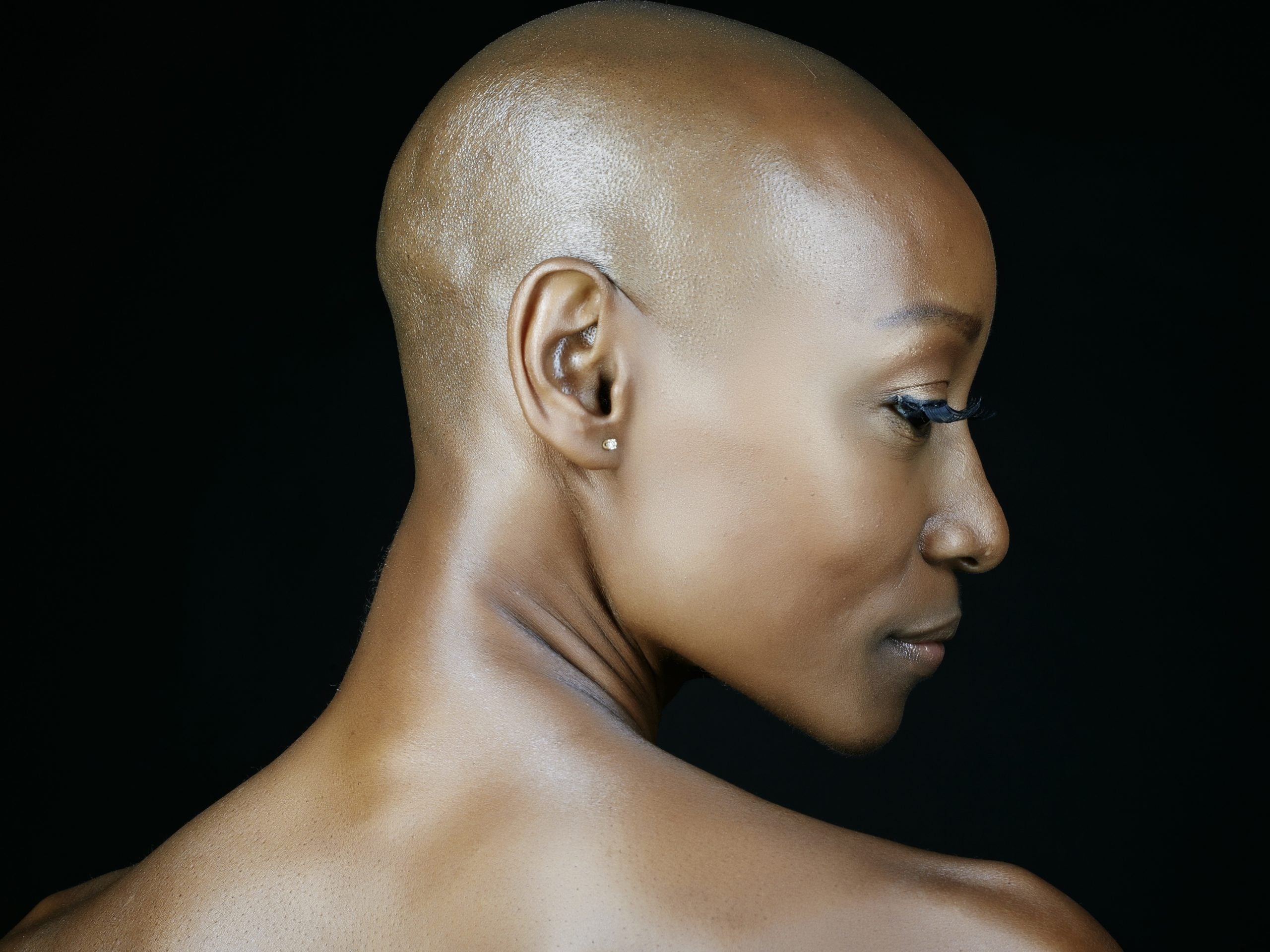 Being Bald Has Been A Surprisingly Pleasant Part Of My Wellness Journey