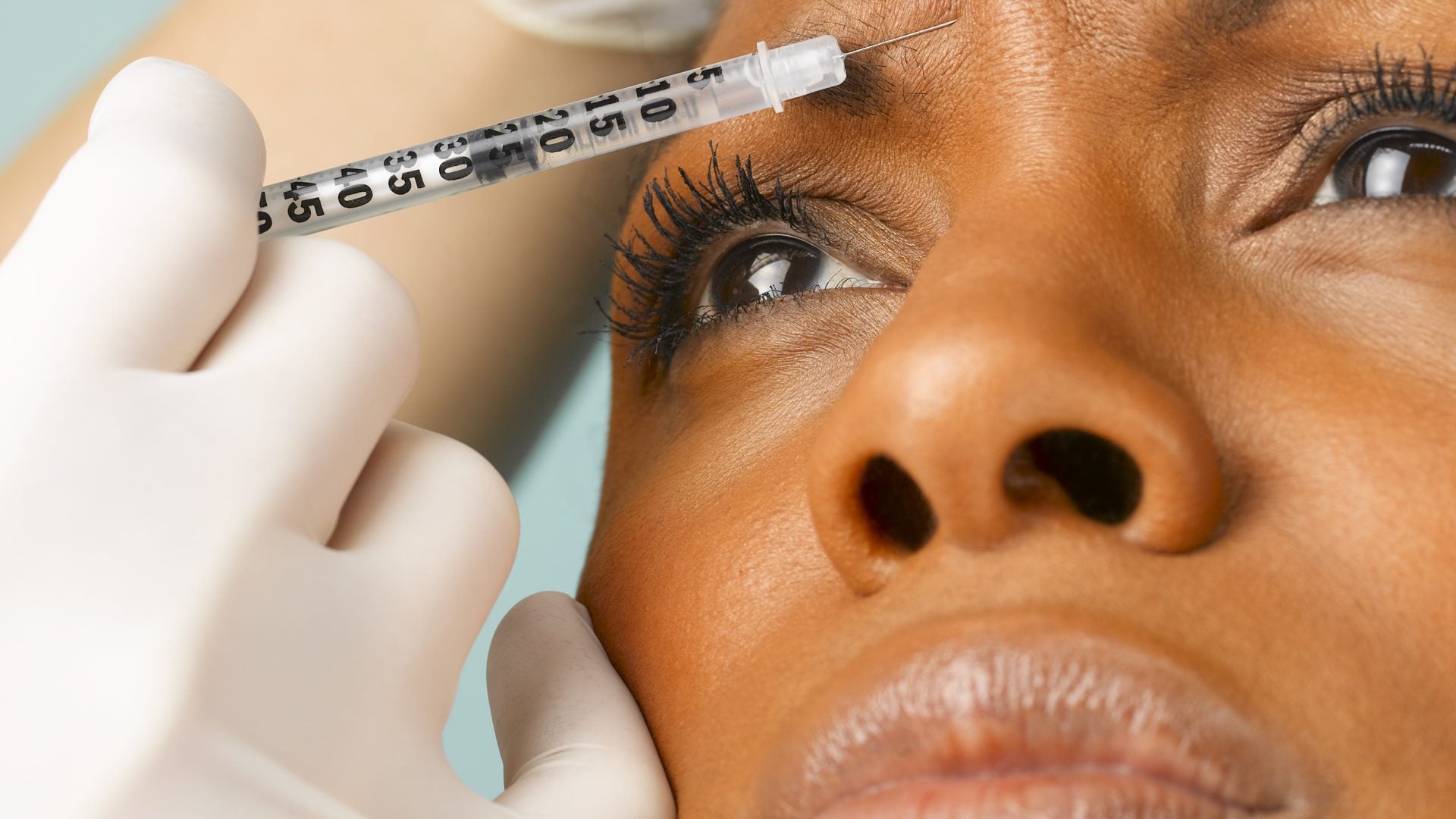 How One Black Woman Is Enhancing Her Botox Treatments With Sculptra