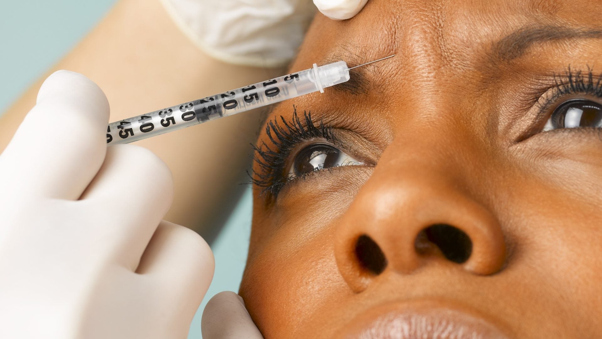 How One Black Woman Is Enhancing Her Botox Treatments With Sculptra