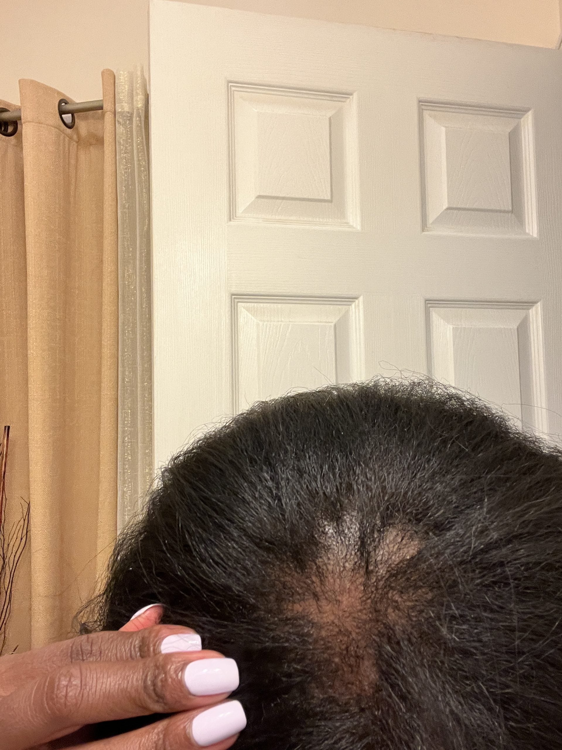 How I Regrew My Thinning Hair