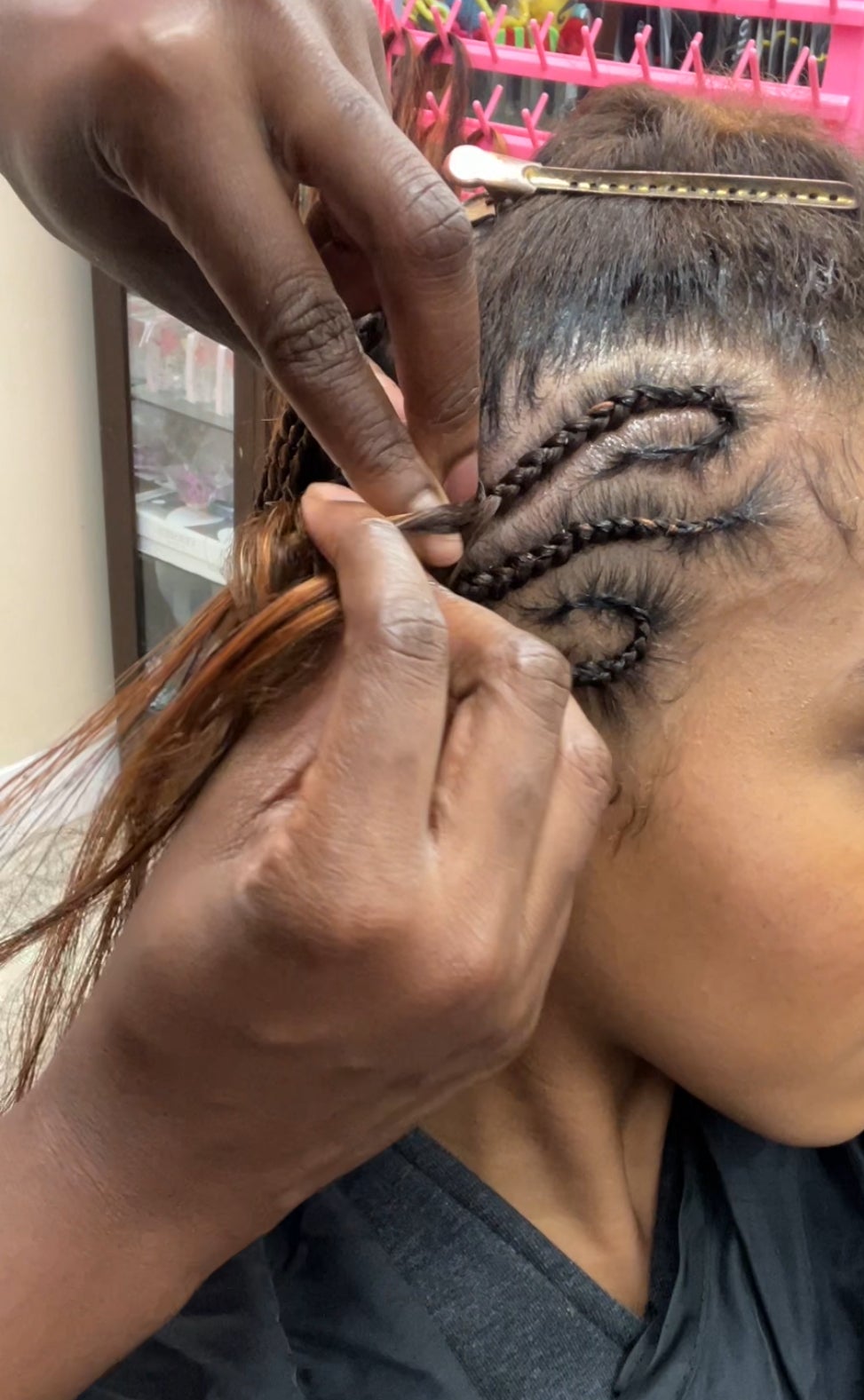A Year Without Braids Helped Me Recover From Traction Alopecia