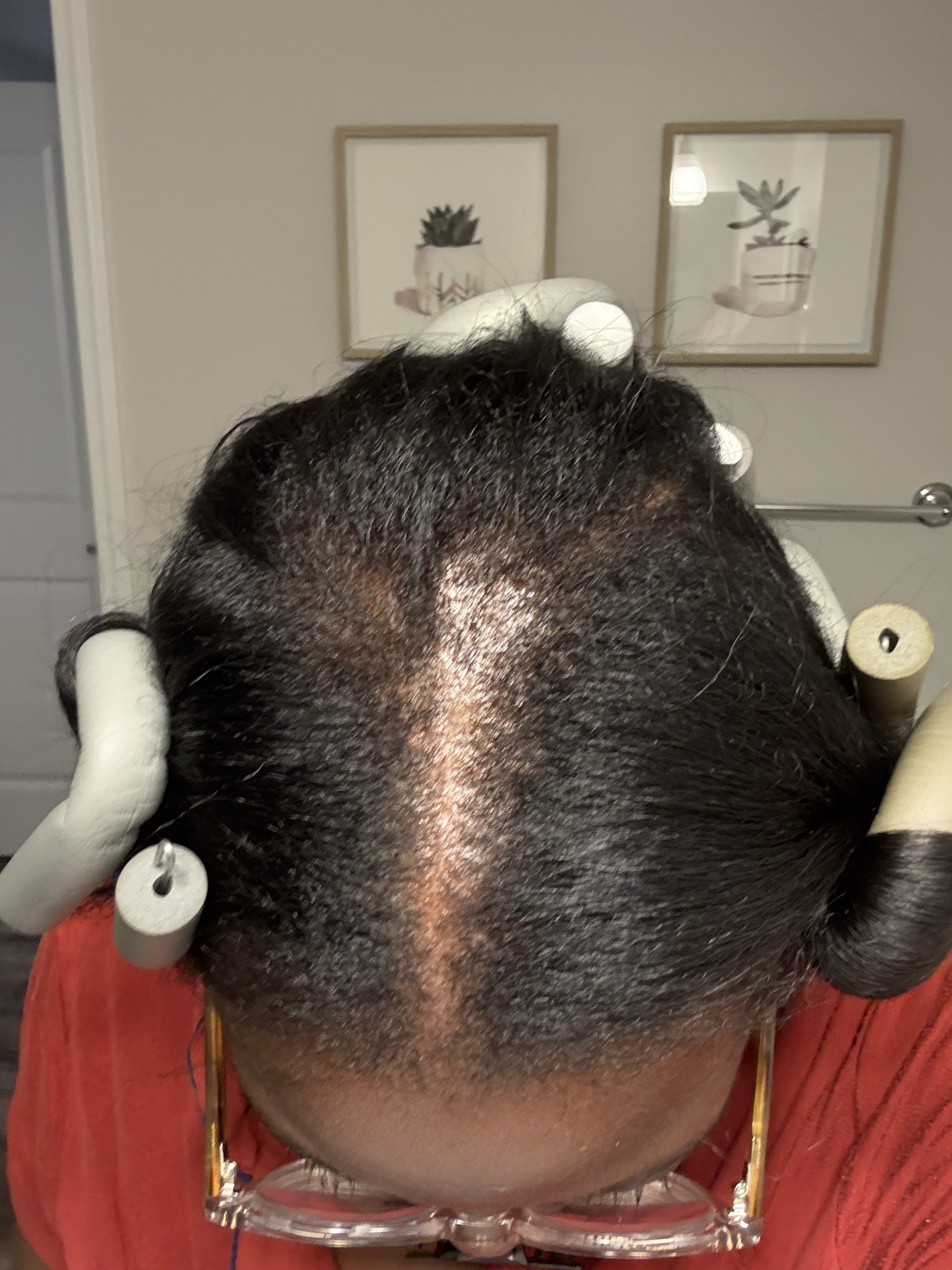 How I Regrew My Thinning Hair