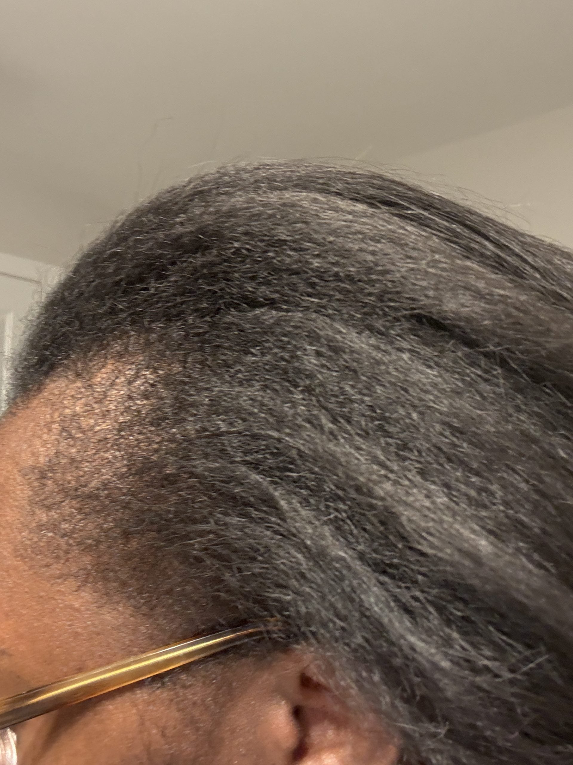 How I Regrew My Thinning Hair
