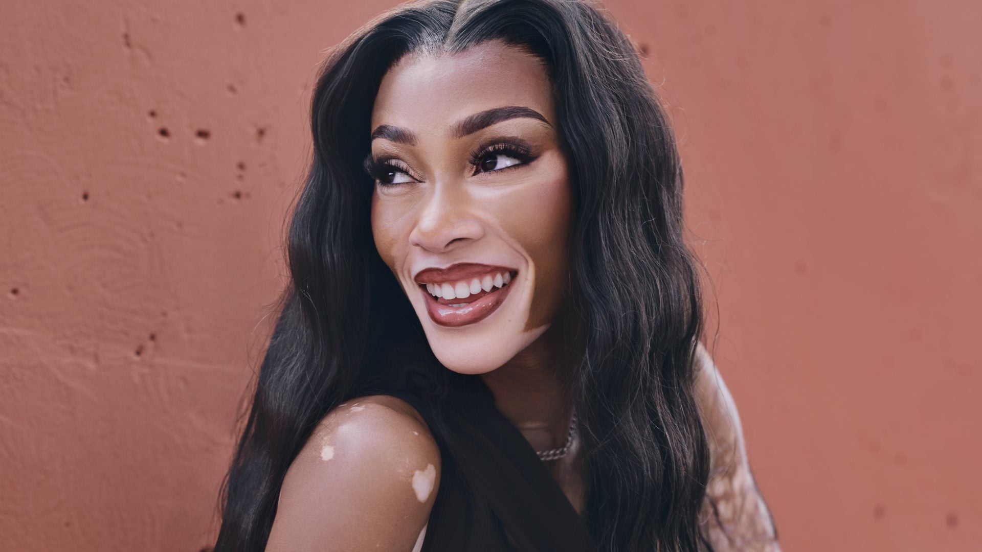 Winnie Harlow Partners With Incyte To Empower The Vitiligo Community